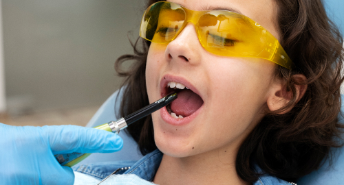 Kids dentistry at clove dental