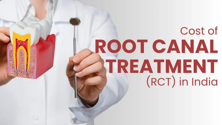 cost of rct in india