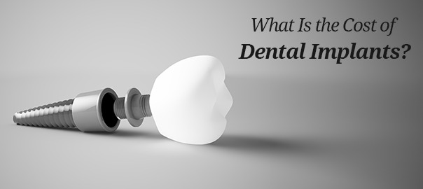 cost of dental implant