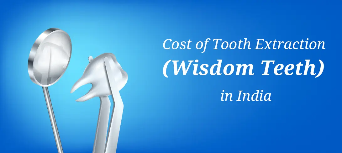 Cost of Tooth Extraction (Wisdom Teeth) in India