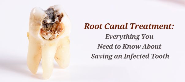 Everything You Need to Know About RCT
