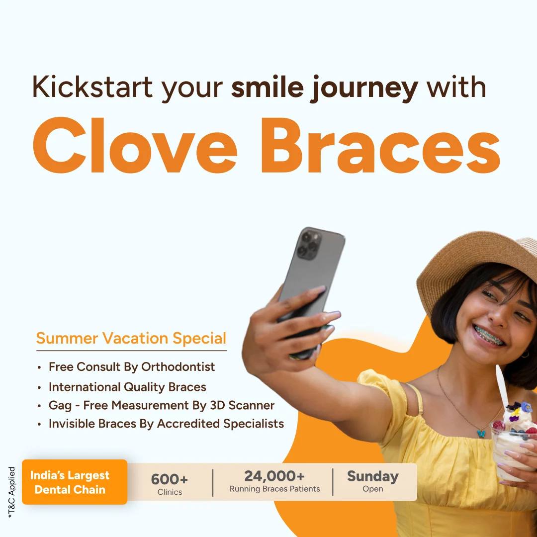 Clove Dental Summer Offers - Braces
