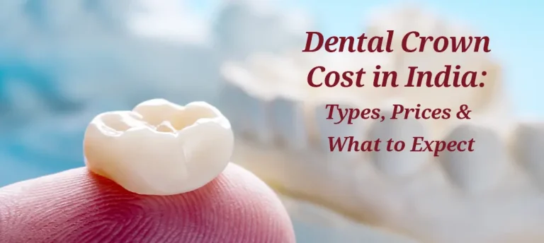 Teeth Cap Price in India: Types of Dental Crowns, Prices & What to Expect