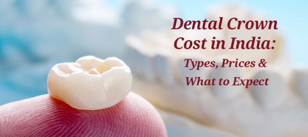 Teeth Cap Price in India: Types of Dental Crowns, Prices & What to Expect
