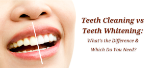 Teeth Cleaning vs Teeth Whitening: What’s the Difference and Which Do You Need?