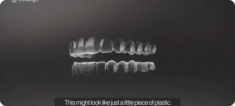 Step by Step Teeth Alignment Procedure