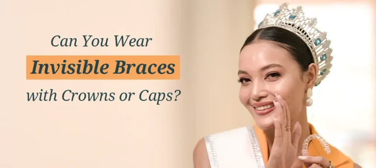 Invisible Braces and Dental Crowns – Can You Get Aligners With Crowns?