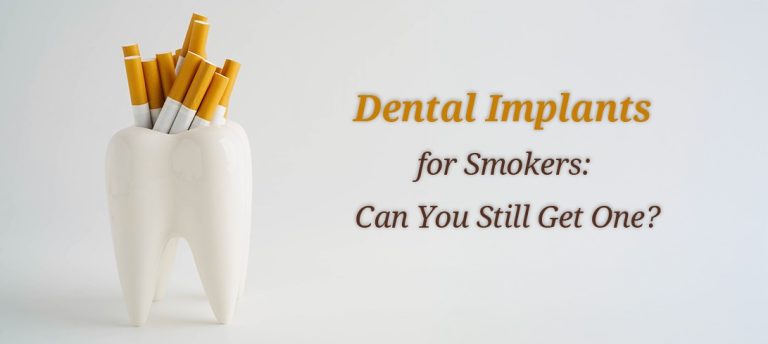 Explaining dental implant process to smoker patient