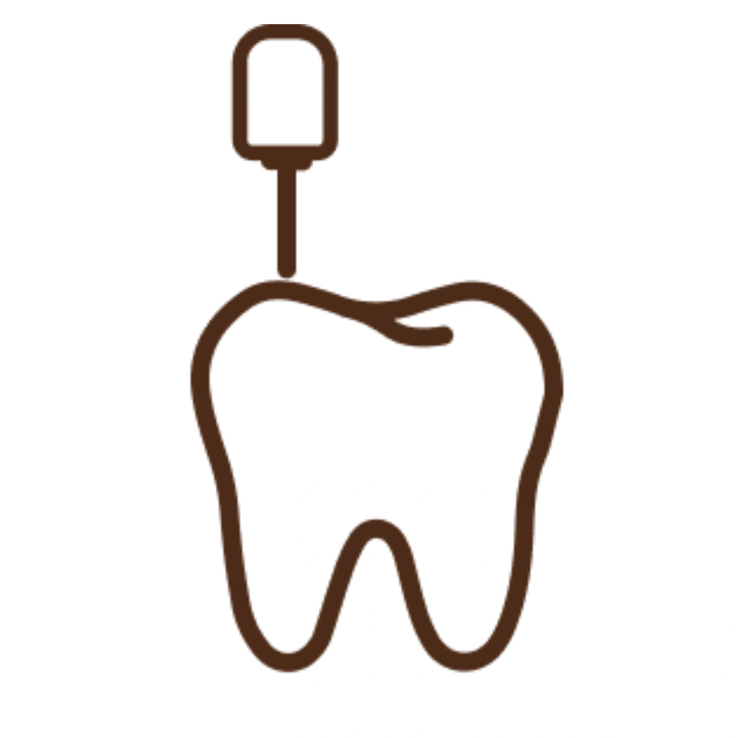 Root Canal Treatment (RCT)