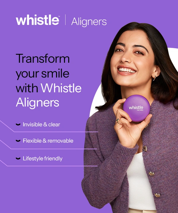 clove dental clinics in bengaluru
