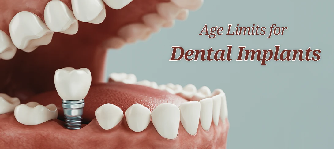 Dental implant treatment near me