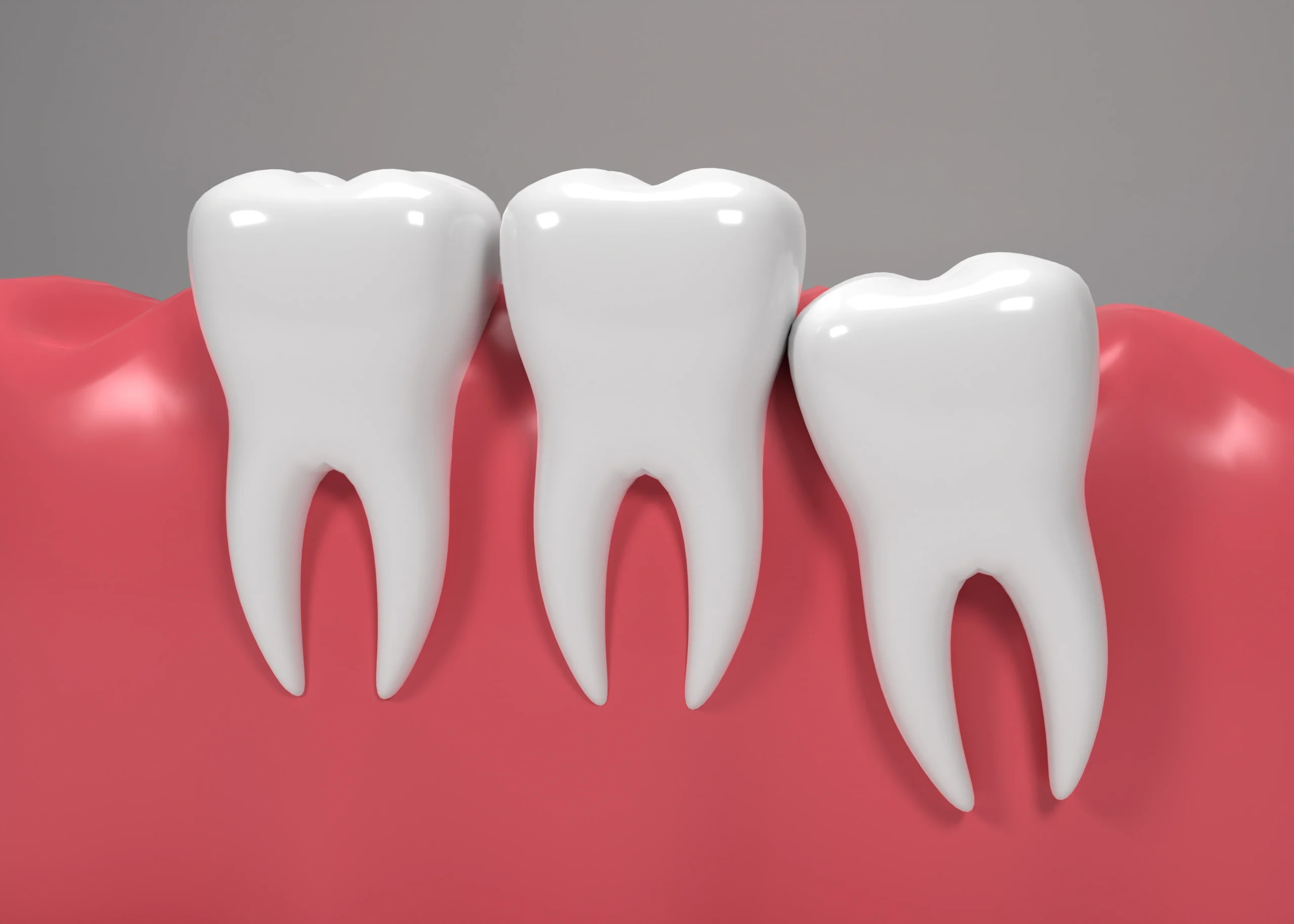 Removing soft tissue