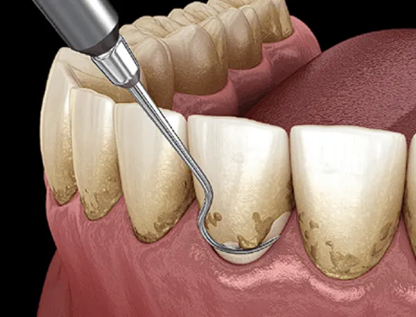 Man holding cheek in pain