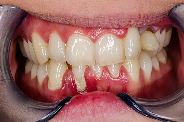 Man holding cheek in pain