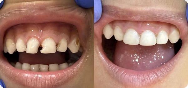 Arjun Mehta Before and After