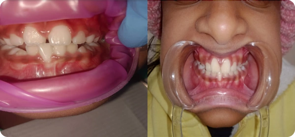 Kavita Sharma Before and After