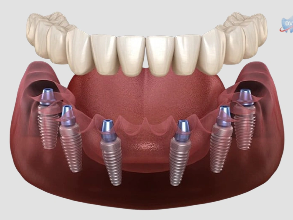 Treating tongue frenulum