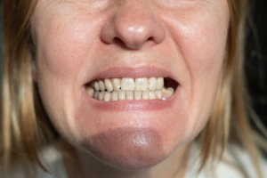 Man holding cheek in pain