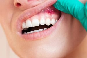 Close-up of discolored teeth
