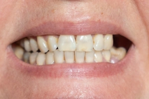 Man holding cheek in pain