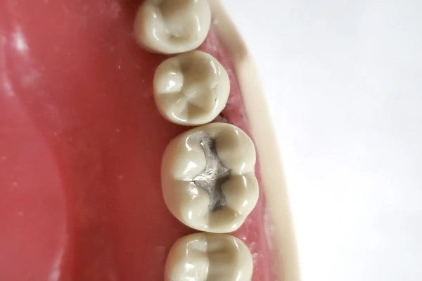 Man holding cheek in pain