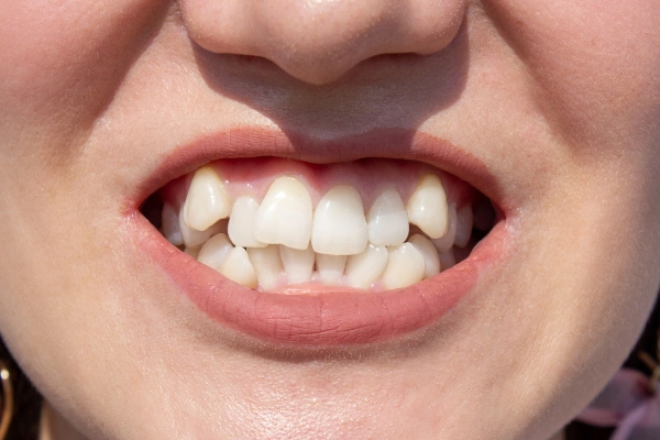 Man holding cheek in pain