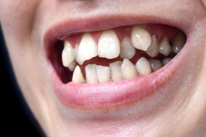 Man holding cheek in pain