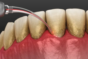 Man holding cheek in pain