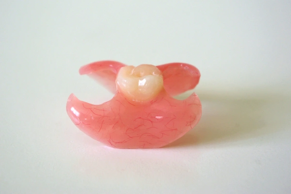 Cracked tooth diagram