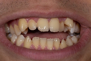 Dentist consulting with patient