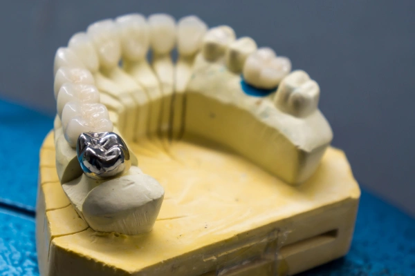 Pus or boil near tooth