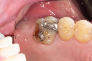 Dentist consulting with patient