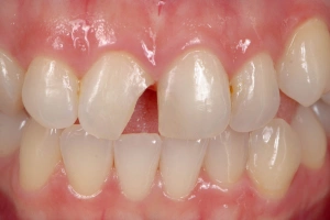 Dentist consulting with patient