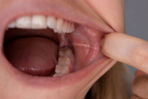 Dentist consulting with patient