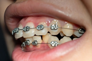 Man drinking hot beverage