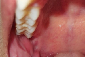Close-up of discolored teeth