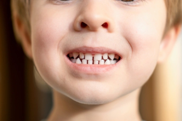 Pus or boil near tooth