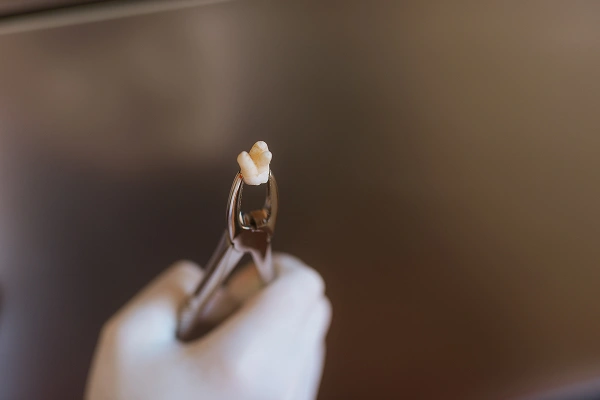 Man holding cheek in pain