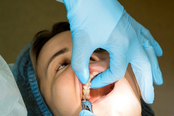 Pus or boil near tooth