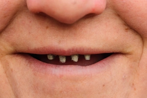 Dentist consulting with patient