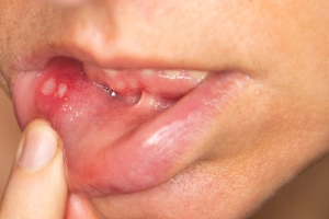 Man holding cheek in pain