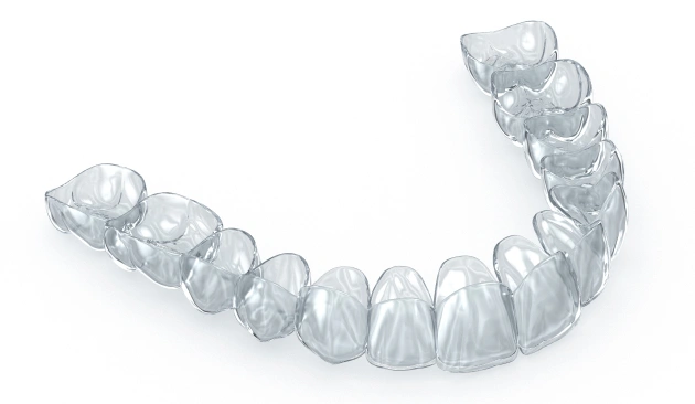 Root Canal Treatment Diagram