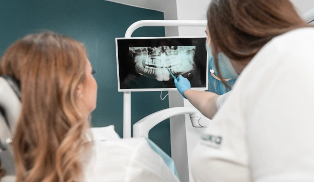 Root Canal Treatment Diagram
