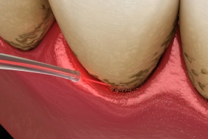 Dentist consulting with patient