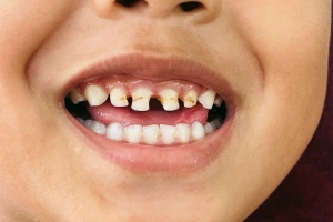 Man holding cheek in pain