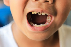 Man holding cheek in pain