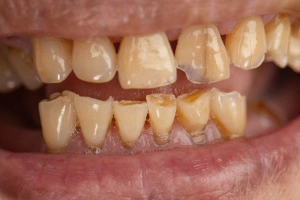 Man drinking hot beverage