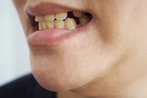 Dentist consulting with patient