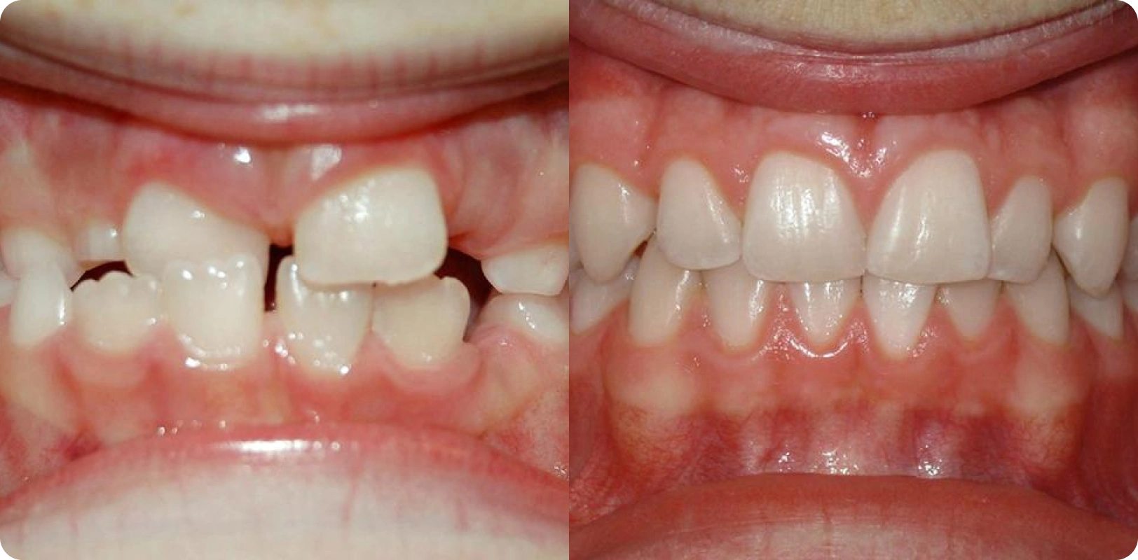 Arjun Mehta Before and After