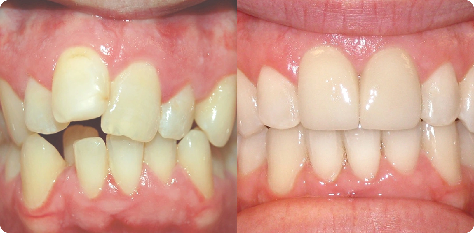 Kavita Sharma Before and After